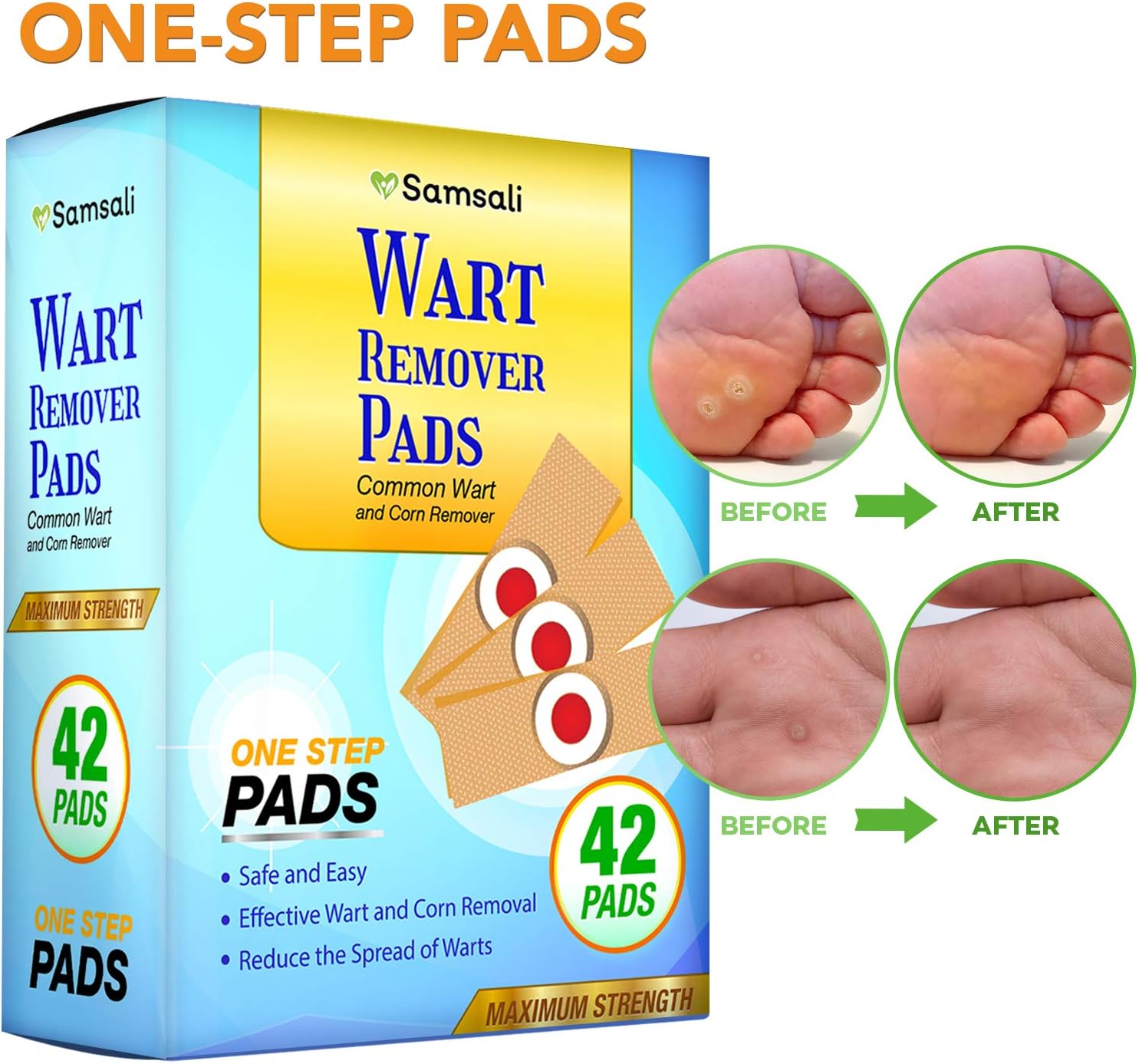 Samsali Wart Remover Pads, Highly Potent Wart Removal Treatment, All New Premium High Efficacy Wart Remover Pads, 42 Wart Remover Pads: Health & Personal Care