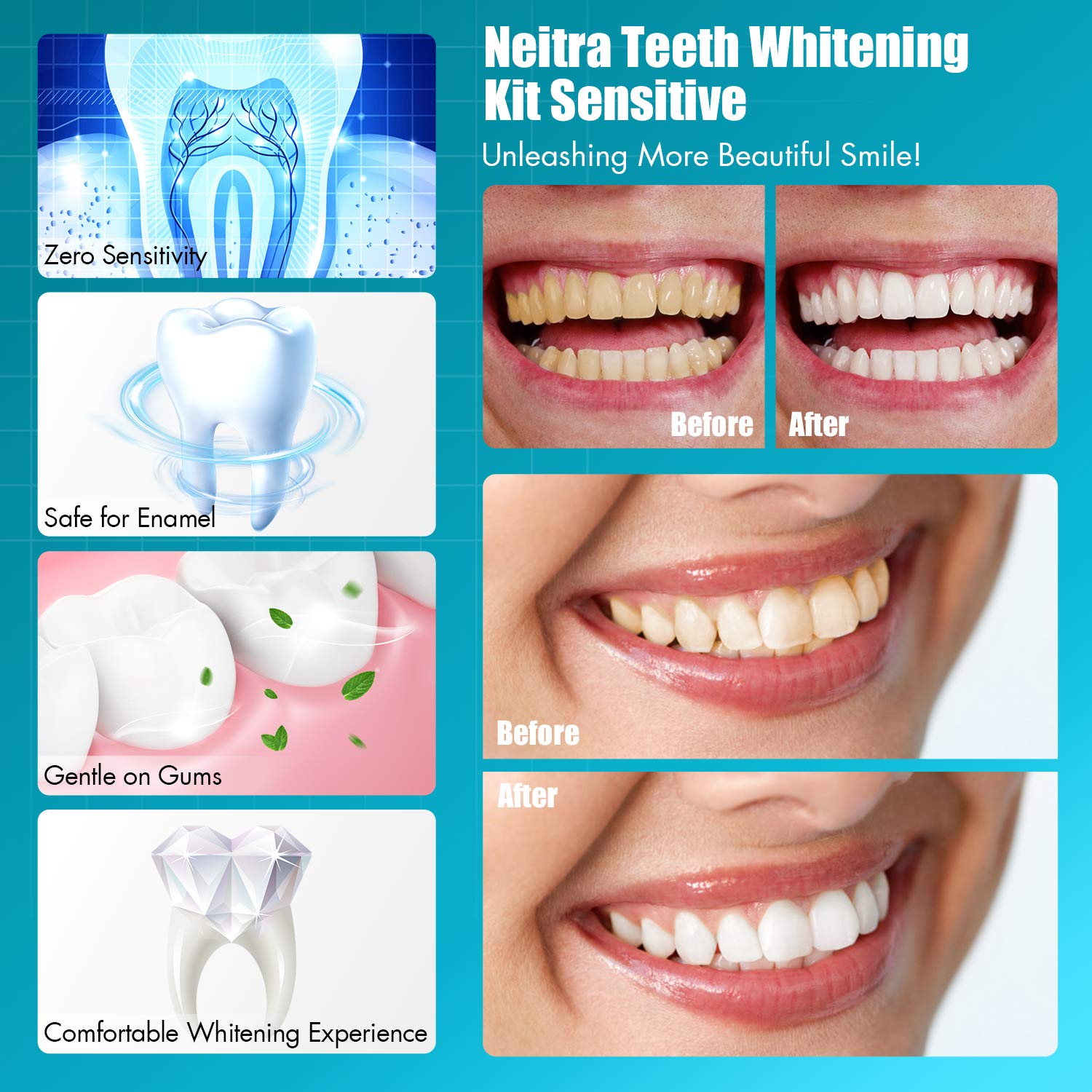Neitra Teeth Whitening Kit with LED Light for Sensitive Teeth, (4) 3ml Non-Sensitive 6% Hydrogen Peroxide Gel, 8 Days Teeth Whitening, 5X Accelerator Teeth Whitener, 10 Min Timer（Sensitive Series): Beauty