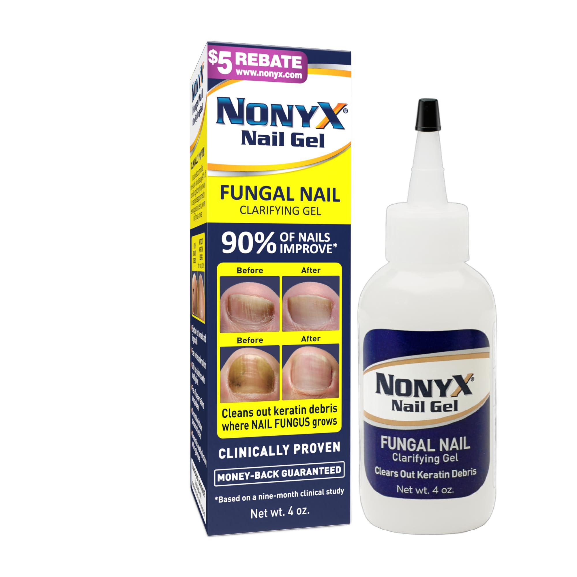 NONYX Nail Clarifying Gel | For Clear, Healthy-Looking Nails | Improves the Appearance of Discolored, Damaged, Thick or Brittle Toenails and Fingernails, 4 oz