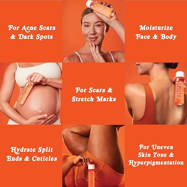 BIO-OIL SKINCARE BODY OIL SERUM, FACE AND BODY MOISTURIZER WITH VITAMIN E & A, FOR SCARS, STRETCH MARKS, SENSITIVE SKIN, ALL SKIN TYPES, DERMATOLOGIST RECOMMENDED, NON-COMEDOGENIC, 2 OZ