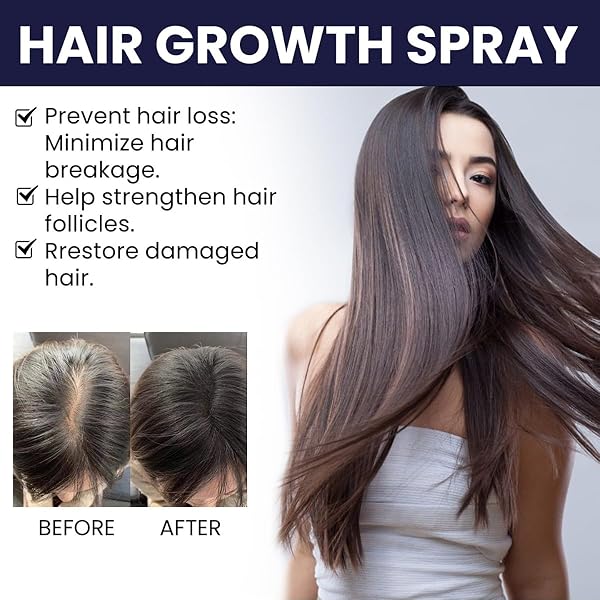 QUAAM 2PCS OUHOE HAIR GROWTH SPRAY, BROWN, UNISEX-ADULTS