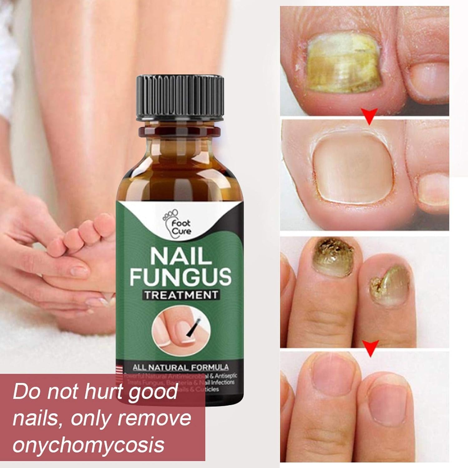 Amazon Co Jp 10ml ネイルリペアソリューション爪真菌治療 爪の修復 足爪用補修液 抗真菌 爪用除菌ケア 灰指甲 爪水虫治療薬 爪 を保護し 爪の健康と再生を回復します ネイルケアに最適 ホーム キッチン Amazon Co Jp 10ml ネイルリペアソリューション爪真菌治療 爪の修復 足爪用補修液 抗真菌 爪用除菌ケア 灰指甲 爪水虫治療薬 爪 を保護し 爪の健康と再生を回復します ネイルケアに最適 ホーム キッチン