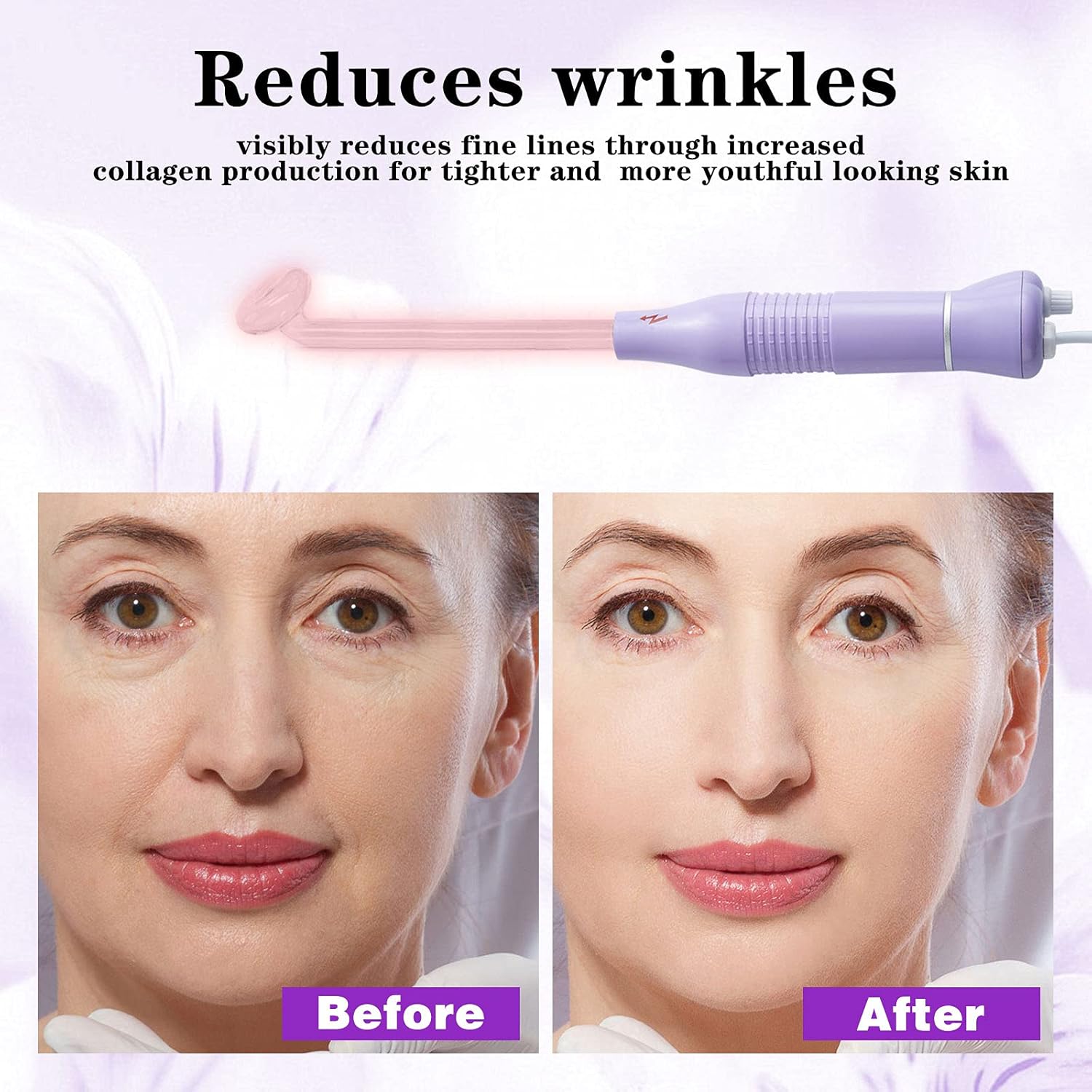 Bvcewilty High Frequency Facial Machine Skin - Portable Handheld Skin Therapy Wand for Acne Wrinkles Remover Skin Tightening: Beauty