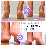 TYGA Foot Rasp Callus Remover - Stainless Steel Foot File, Wet/Dry Use view 6