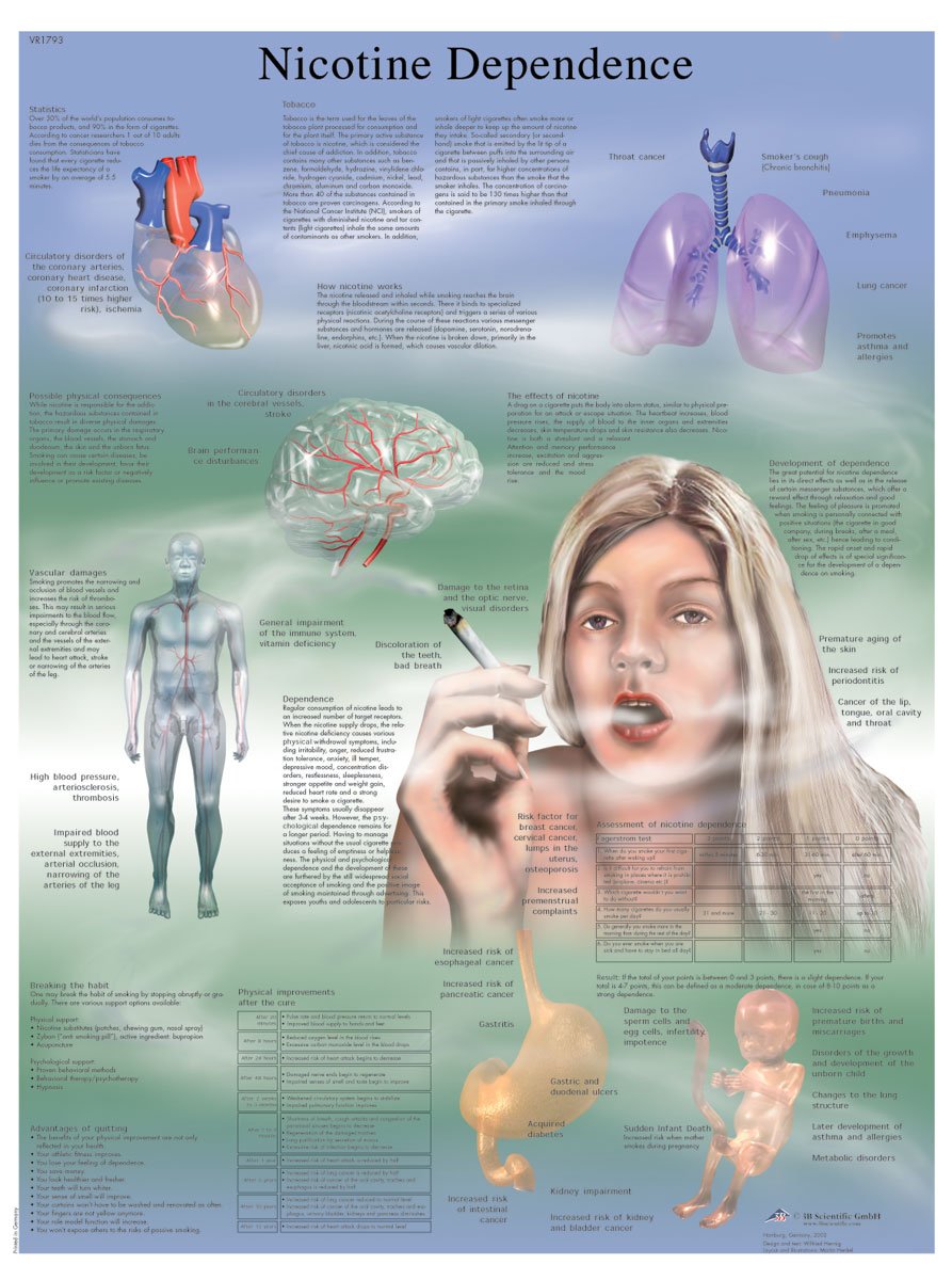 3B Scientific Human Anatomy - Nicotine Dependence Chart, Laminated Version