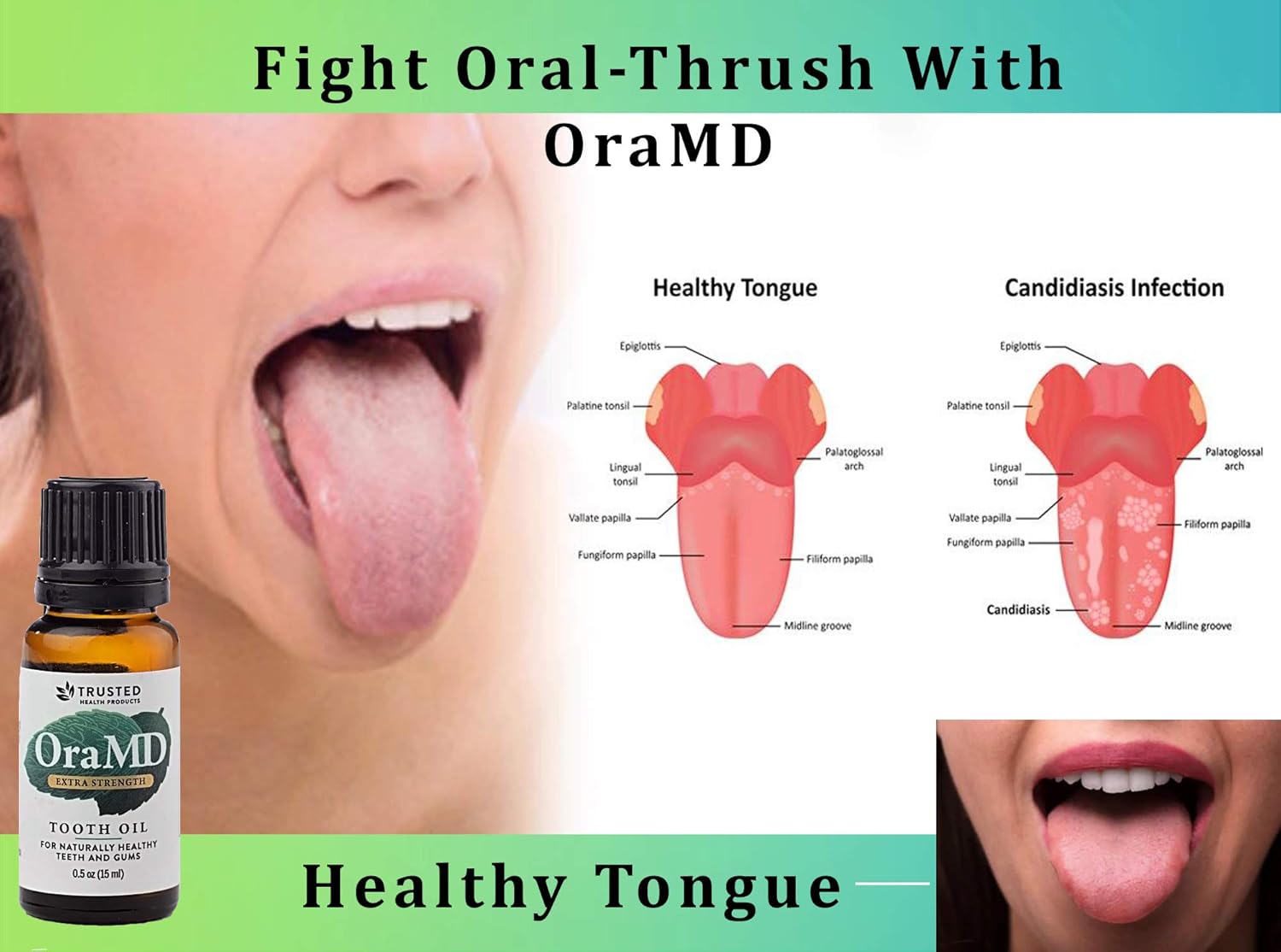 OraMD Original Dentist Recommended Worldwide 100% Pure Breath Freshener for Bad Breath, Halitosis Canker Sores, Gum Boils and Tooth Abscesses - 1 Bottle: Beauty
