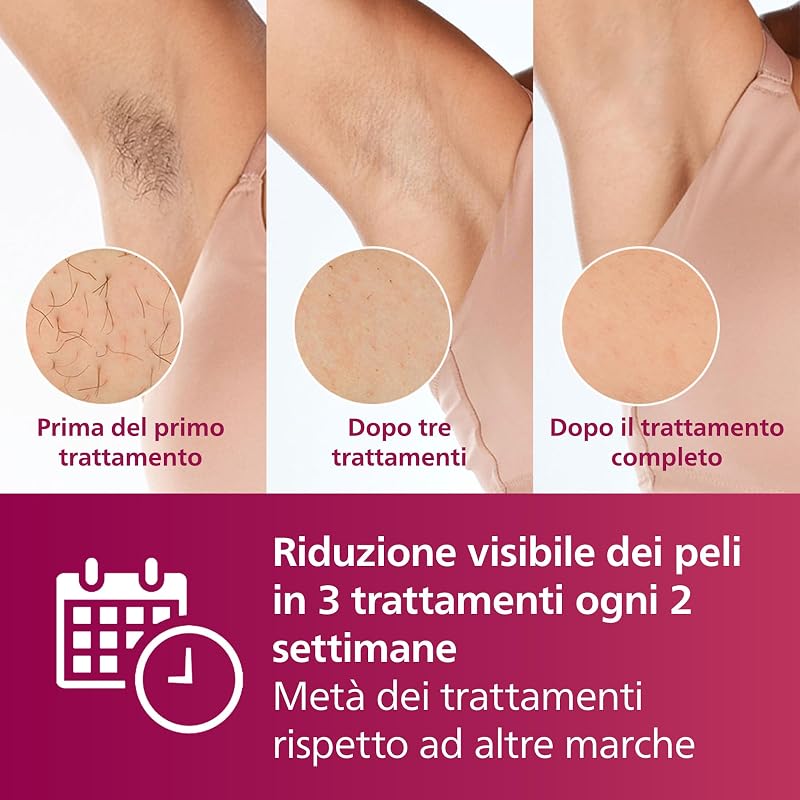 Lumea 7000 Series,dispositivo di epilazione IPL, alternativa ai dispositivi di epilazione laser, 3 accessori per viso, corpo e zona bikini, modello SC1999/00