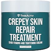 TreeActiv Crepey Skin Repair Cream, 8 oz Firming Body & Neck Cream with Hyaluronic Acid, Glycolic Acid & Shea Butter, Helps Crepey Skin Look Smoother, 500+ Uses