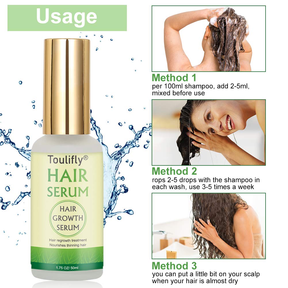 Hair Growth Serum, Hair Loss and Hair Thinning Treatment, Stops Hair Loss, Natural Herbal Essence, Thinning, Balding, Repairs Hair Follicles, Promotes Thicker, Stronger Hair and New Hair Growth(50ml) : Beauty