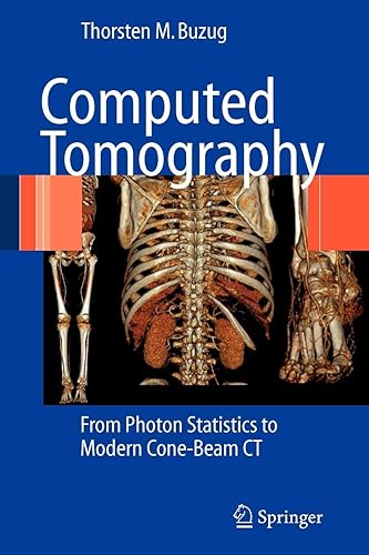 Download Computed Tomography: From Photon Statistics to Modern Cone-Beam Ct PDF