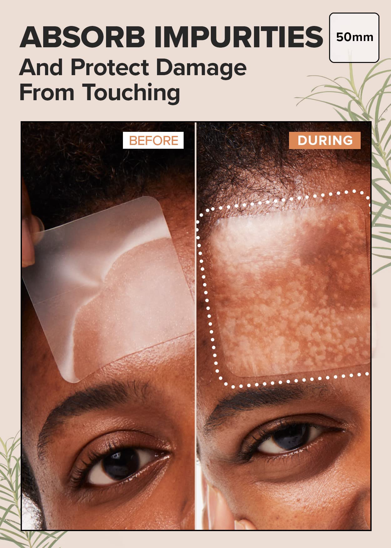 I DEW CARE Hydrocolloid Acne Pimple Patch - Timeout Blemish Wide | Korean Zit Dark Spot Patches for Face and Skin, Pus absorbing with Tea Tree Oil, Trouble Remover Treatment, Big Large Size, 6 Count
