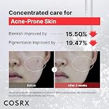 COSRX Niacinamide 15% Serum Pores Sebum Dark Spots Blemish Treatment 20ml view 4
