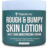 TreeActiv Rough and Bumpy Skin Lotion, 8 fl oz, With Hyaluronic Acid, Shea Butter and Vitamin E, Nourishing Lotion for Rough and Bumpy Skin, Moisturizing Strawberry Legs, For All Skin Types
