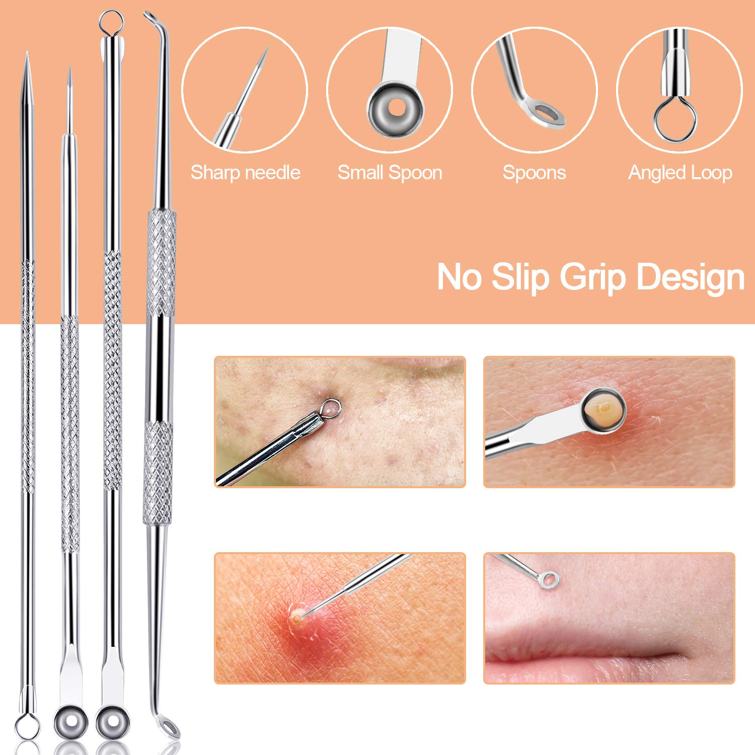 Blackhead Remover Pimple Popper Tool Kit 10 Pcs, Comedone Pimple Extractor Tool, Acne Kit for Blackhead, Whitehead Popping, Zit Removing: Beauty