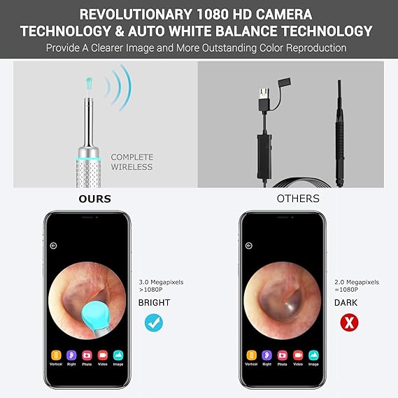 Amazon Com Ear Wax Removal Enow 3 5mm Earwax Removal Otoscope Tools 3 0 Megapixels Wireless Endoscope Ear Camera Wax Remover Kit Wifi Ear Scope Cleaner With 6 Led Lights For Kids Adults Ios Iphone Android Health