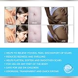 Sure Medical Advanced Medical Grade Silicone Scar Gel 60g view 2