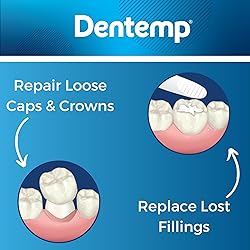 Dentemp Maximum Strength Loose Cap and Lost Filling