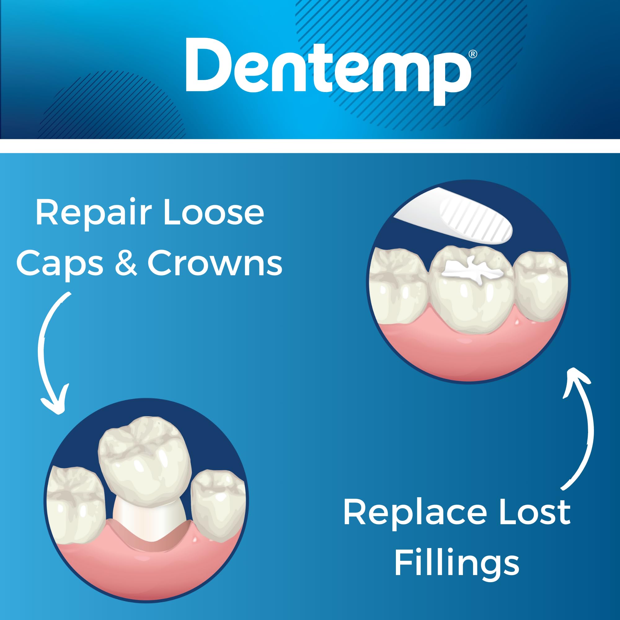 Dentemp Maximum Strength Loose Cap and Lost Filling Repair - Dental Repair Kit for Instant Pain Relief (Pack of 2)