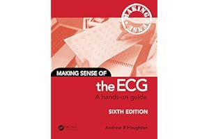 Making Sense of the ECG: A Hands-On Guide
