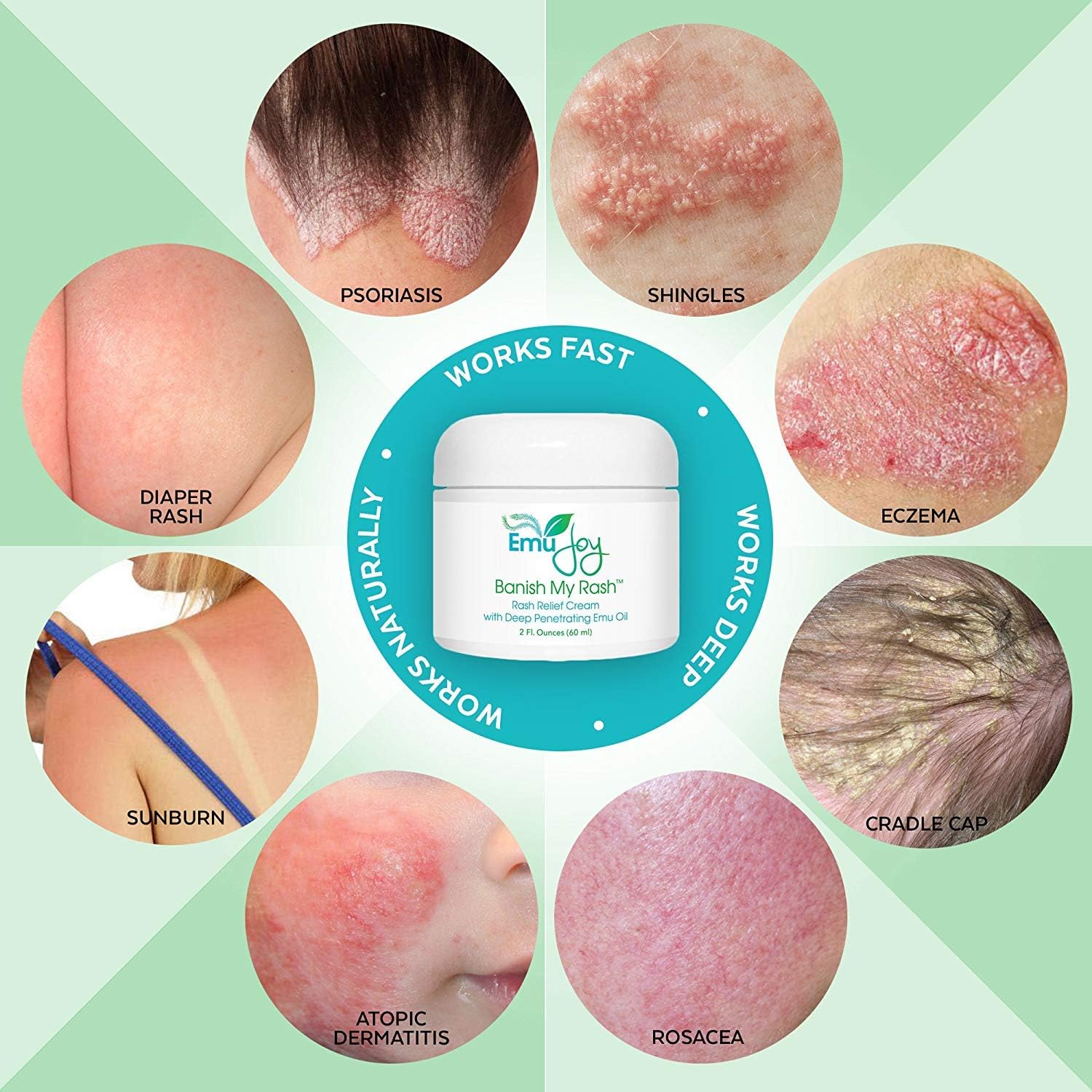 Emu Joy Soothe My Rash Kit for Eczema Psoriasis LIchen Sclerosus Rosacea Dermatitis - Natural Organic Relief for Irritated Skin: Health & Personal Care
