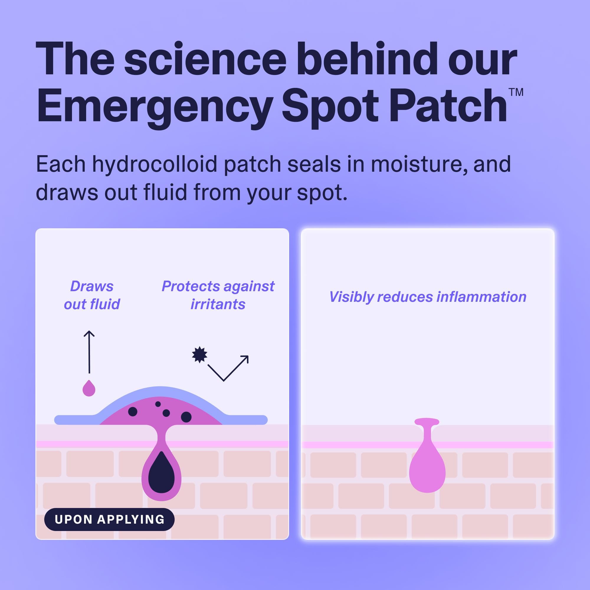 Curology Emergency Spot Pimple Patches for Face, Stocking Stuffer Gifts, Hydrocolloid Pimple Patches Fast-Acting, 40 Count