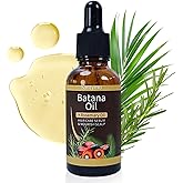 Batana & Rosemary Hair Growth Oil 2oz – Scalp Treatment & Strengthening for Growth & Loss, Thinning, Dry Scalp, Split Ends – Natural Hair Oil for Women & Men – Intensive Repair & Nourishing Formula