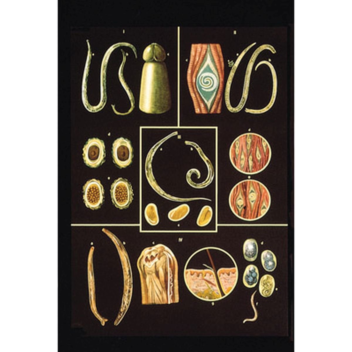3B Scientific Human Anatomy – Intestinal Parasites II Chart – BigaMart
