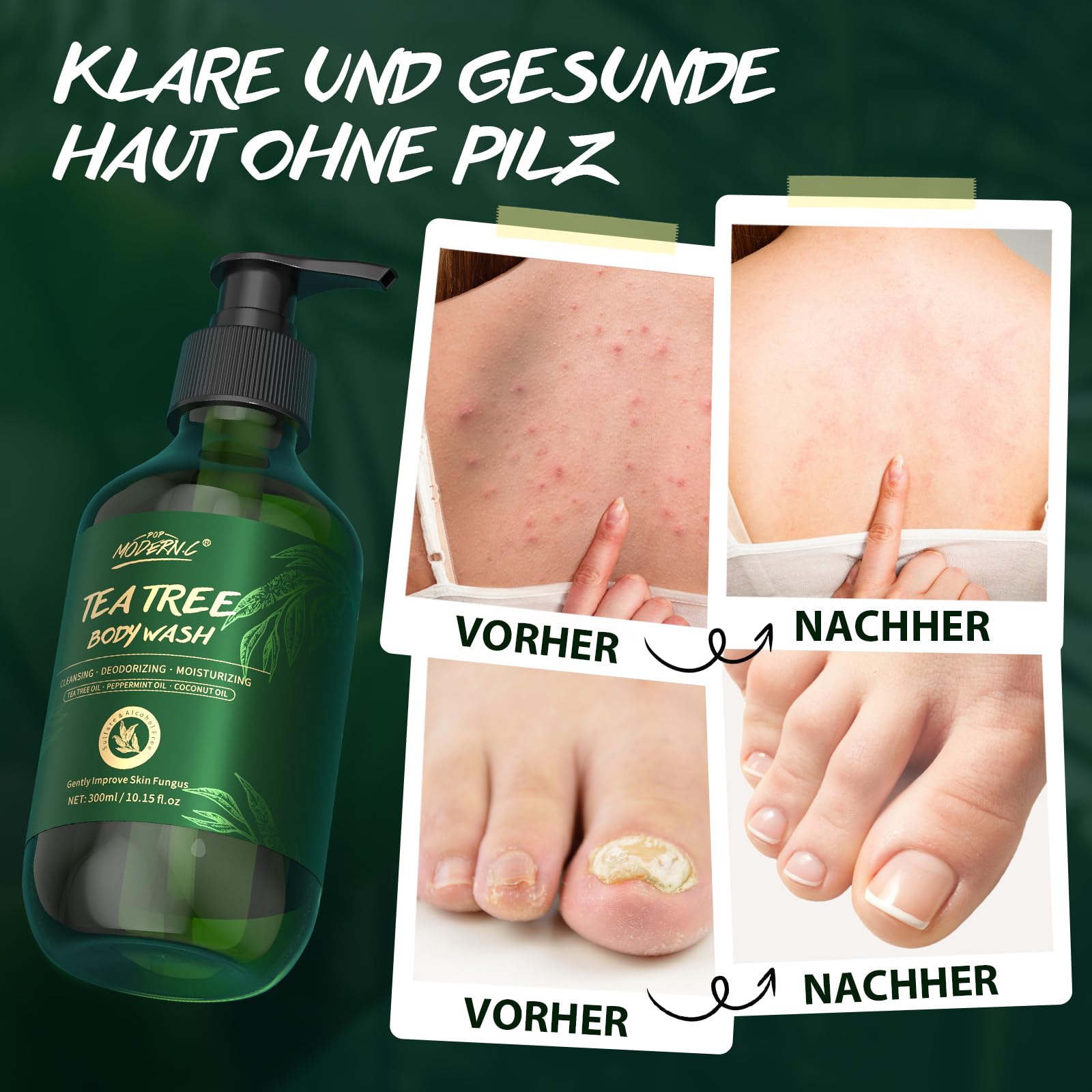 ‎Teebaum-Duschgel, Lindert Hautpilz, juckende Haut, Leistenflechte, Fußpilz, Ekzeme und Körpergeruch, Teebaum Körperwäsche mit Pfefferminzöl und Kokosöl, Duschgel mit Pumpe für Männer Frauen, 300 ml 5