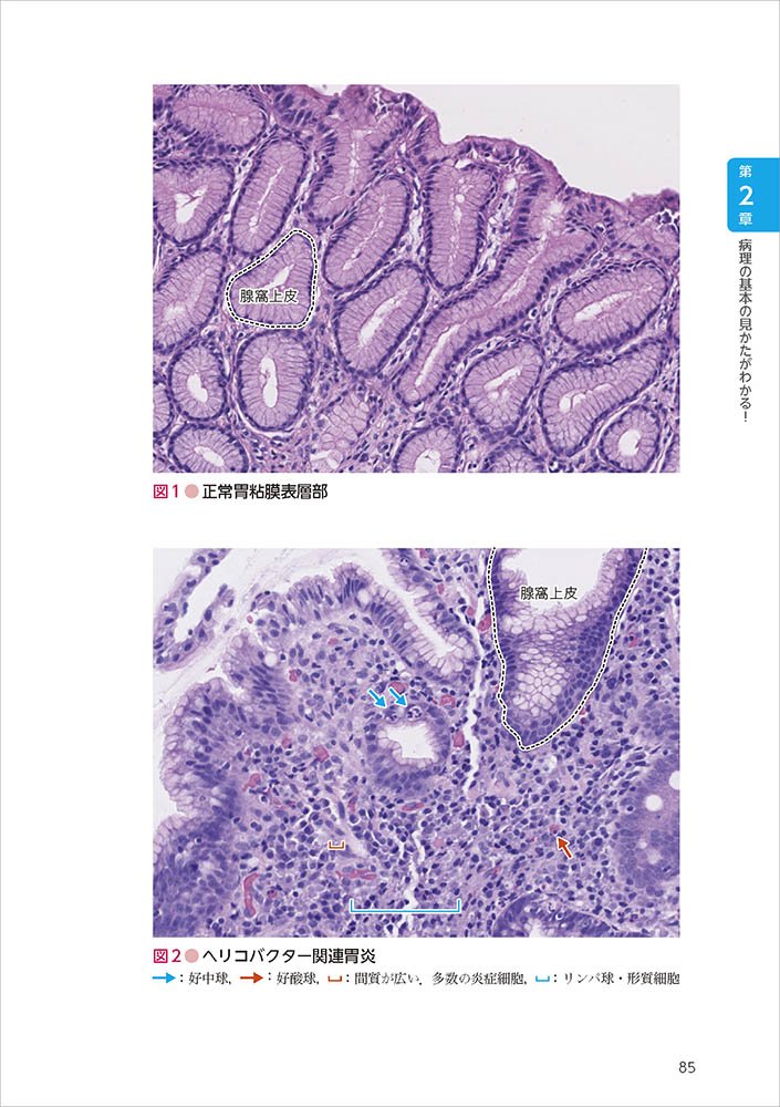 Amazon Co Jp 臨床に役立つ 病理診断のキホン教えます 伊藤智雄 Japanese Books