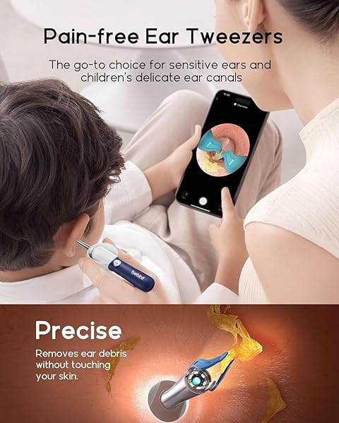 BEBIRD EARSIGHT PLUS D39R EAR WAX REMOVAL TOOL CAMERA, FSA HSA ELIGIBLE ITEMS, EAR CLEANER WITH FLEXIBLE EAR CAMERA OTOSCOPE, VISUAL EAR PICK TWEEZERS WAX REMOVER, EAR CLEANING KIT FOR FAMILY