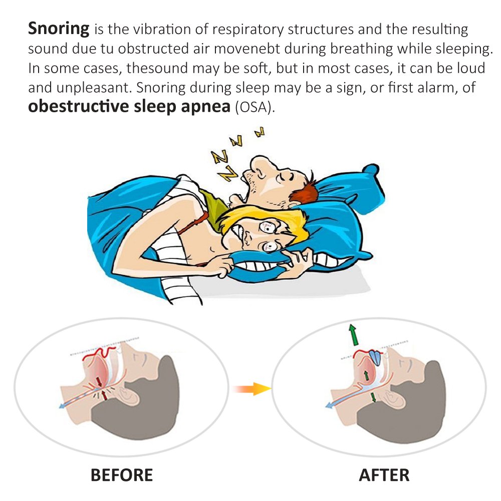Sleep Mouth Guard for Grinding Teeth Sleep Aid Dental Night Guard for