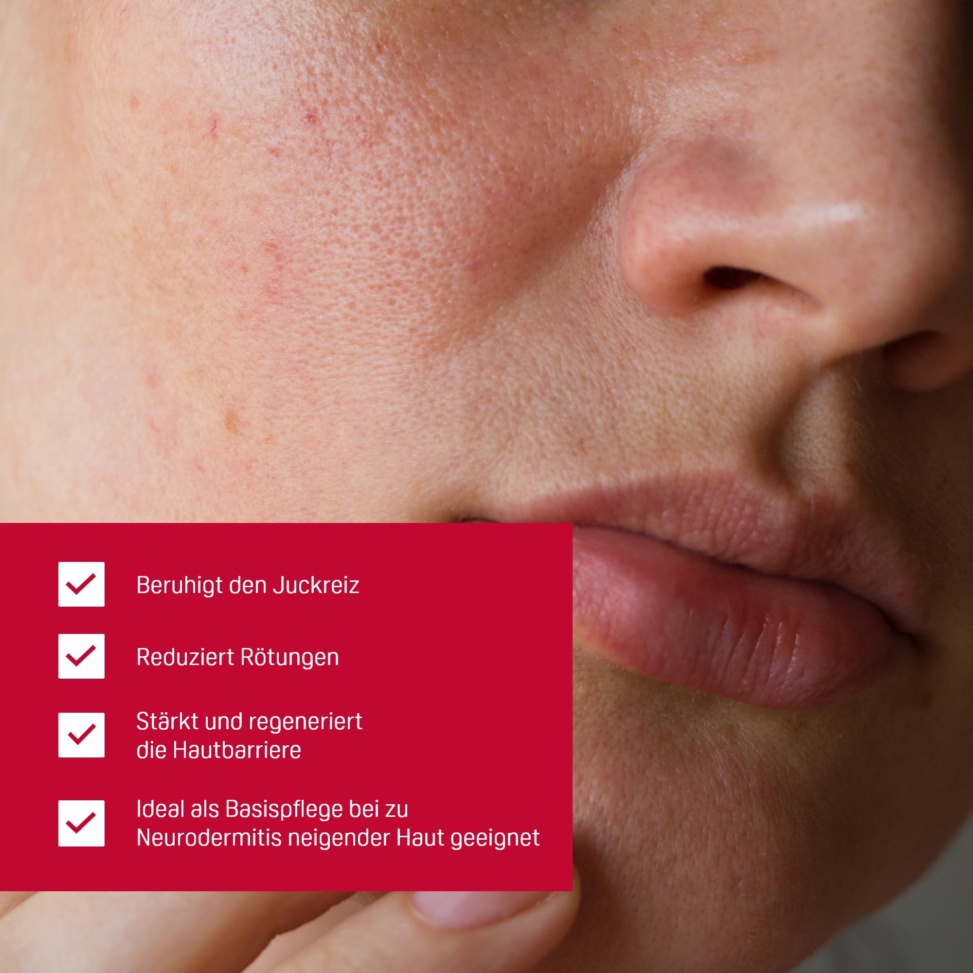 PHYSIOGEL Calming Relief A.I. Creme 100 ml - beruhigende Hautcreme für empfindliche Haut - regenerierende Körpercreme bei Juckreiz und Reizungen der Haut 3