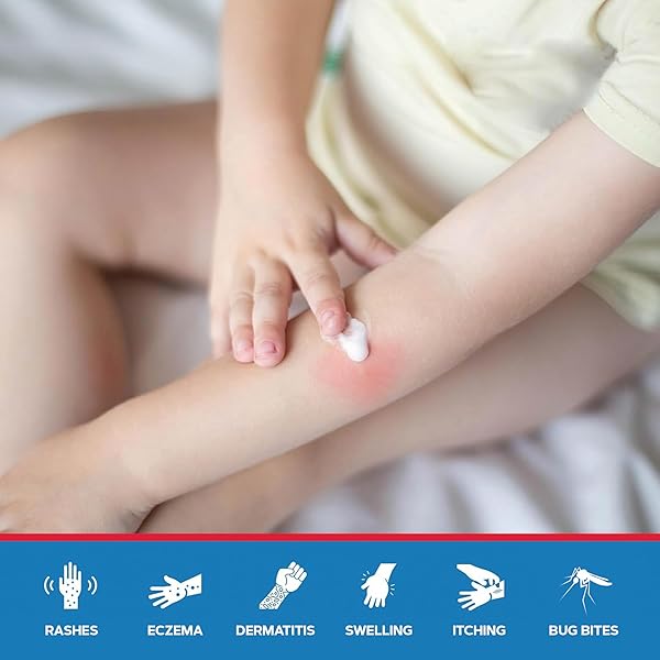 MED PRIDE HYDROCORTISONE 1 OZ TUBE CREAM, 1% FOR HEMORRHOIDS, HEMORRHOID HYDROCORTISONE CREAM, ANTI-ITCH OINTMENT FOR ITCHING, SWELLING, RASH, DERMATITIS, BUG BITES