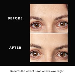 FAQ Hyaluronic Acid Patches For Forehead - Forehead