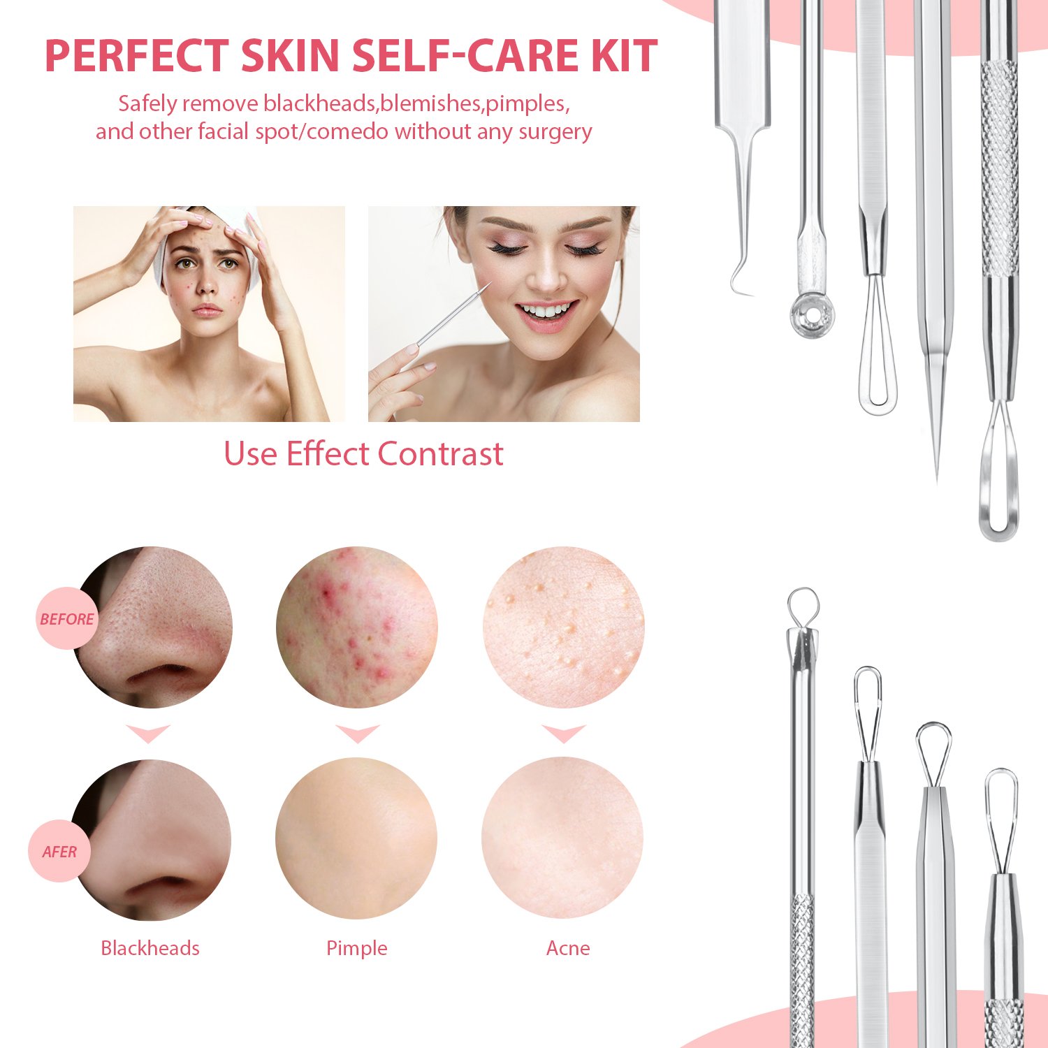 JPNK Blackhead Remover Comedone Extractor Acne Removal Kit: Beauty