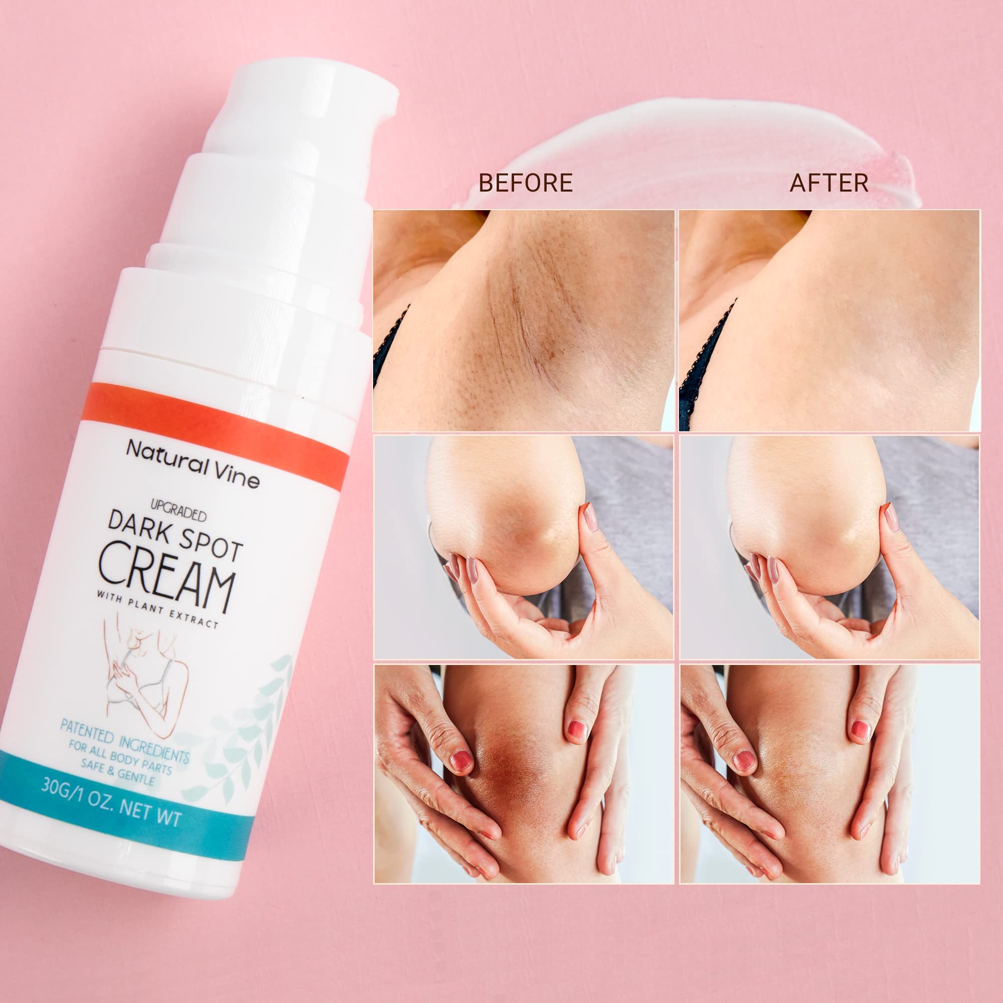 Body Spot Remove Mua Natural Vine Dark Spot Remover for Body, Dark Spot Corrector Cream ...