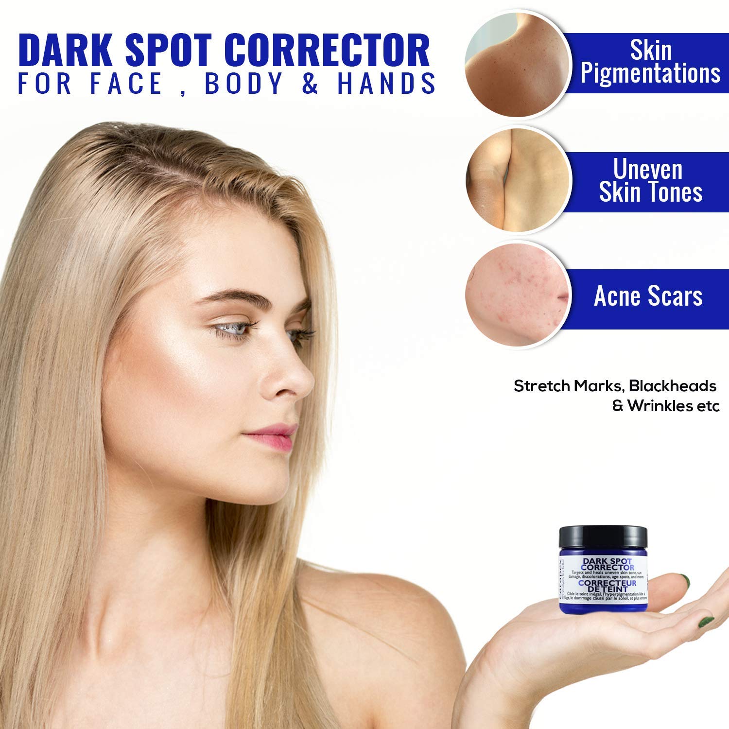 carapex dark spot corrector