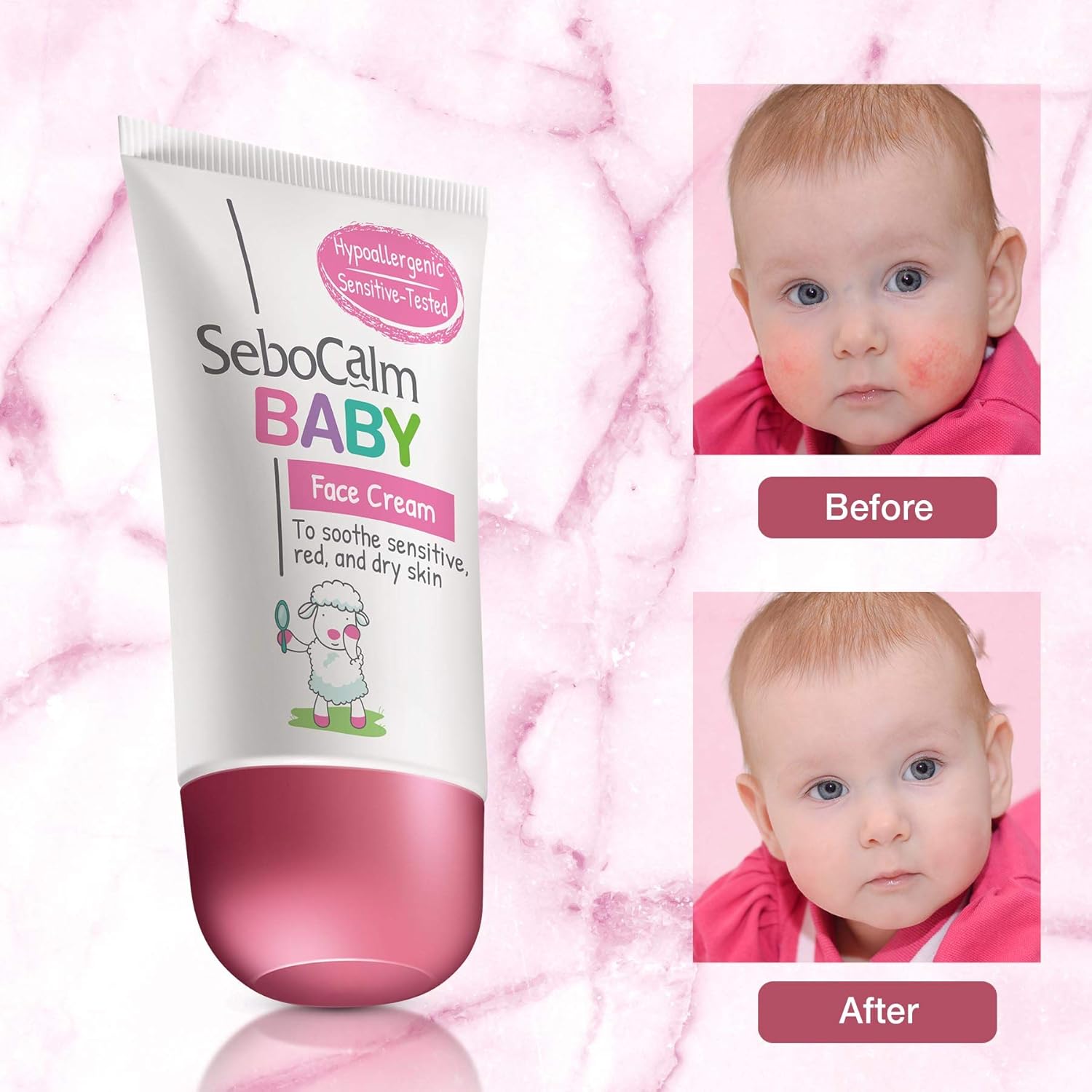 hypoallergenic moisturizer for babies