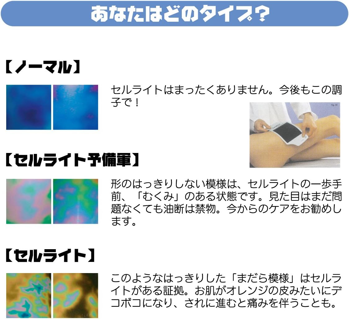 Cell Vision Personal At Any Time Easily Cellulite Checker Amazon Co Uk Health Personal Care