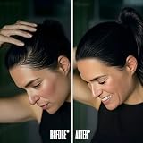 FIXXIE Hairline Powder Root Touch Up Hair Loss Concealer Black view 8