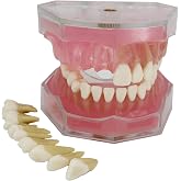 Smile1000 Dental Implant Teeth Model with Removable Teeth for Dental Professionals and Students