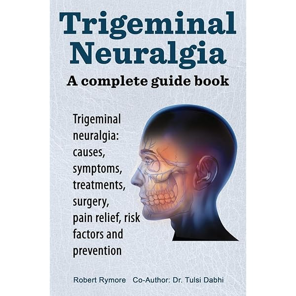 Occipital Neuralgia Explained Migraines, Neuralgia In Head, Facial