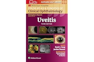 Uveitis