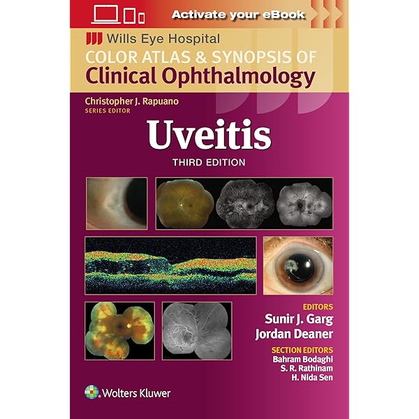 OCT アトラス 第2版 OCTアトラス 第2版 | 書籍詳細 | 書籍 | 医学書院