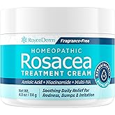 Roycederm Rosacea Treatment for Face with Azelaic Acid – Redness Relief & Corrector – Sensitive Skin Moisturizer for Redness, Bumps & Irritation with & Sulphur, Niacinamide, Centella & Ceramides