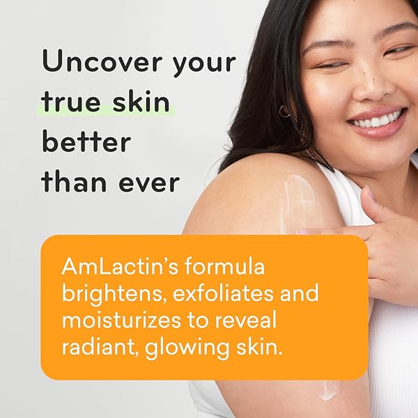 AMLACTIN DAILY VITAMIN C LOTION – 7.9 OZ BODY LOTION WITH 7% LACTIC ACID – SKIN-BRIGHTENING EXFOLIATOR AND MOISTURIZER FOR DRY SKIN
