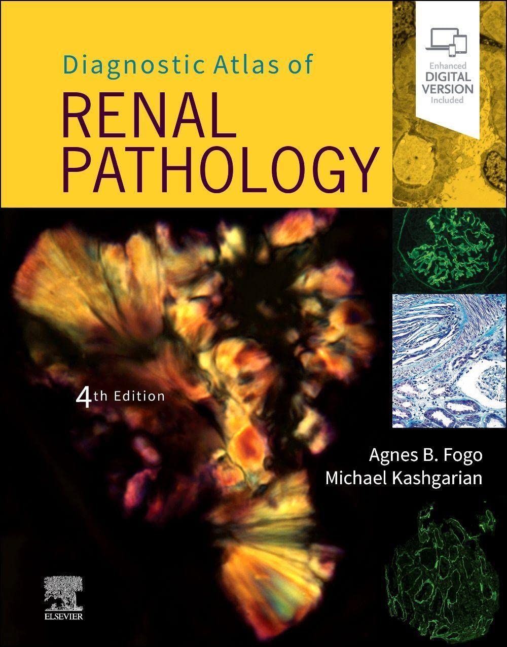 Photo 1 of Diagnostic Atlas of Renal Pathology
