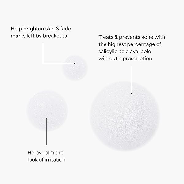 TULA SKIN CARE KEEP IT CLEAR – ACNE FOAM CLEANSER, CONTAINS SALICYLIC & AZELAIC ACID & PROBIOTICS, CLEARS & SOOTHES ACNE, BRIGHTENS PAST BLEMISH MARKS, 6.3 FL OZ.
