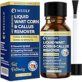 MEOLY Fast-Acting Wart Remover Freeze Off : Salicylic Acid Wart Remover for Plantar Wart, Corn Freeze Off Fast-Acting for Men and Women 30 ML