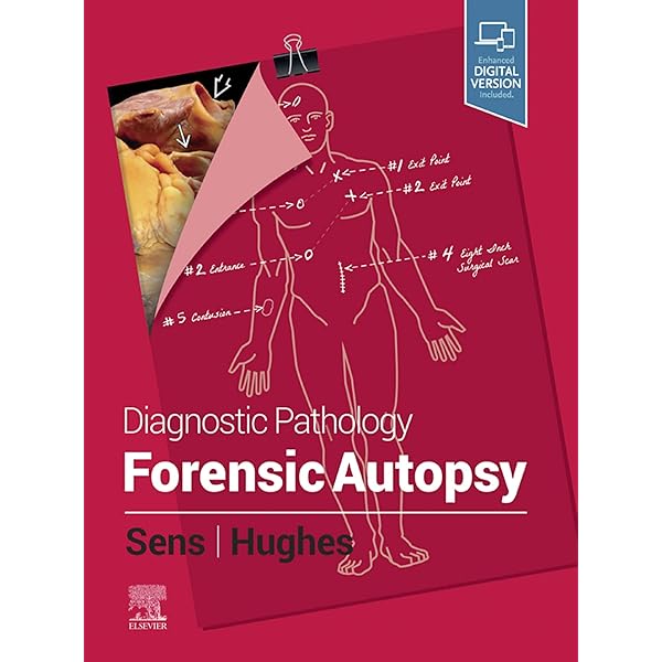 Amazon.com: Diagnostic Pathology: Cardiovascular eBook
